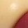 BEAD